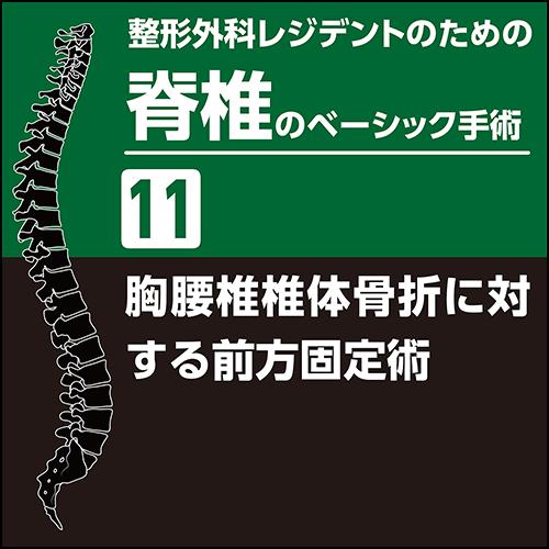 整形外科レジデントのための脊椎のベーシック手術11 胸腰椎椎体骨折