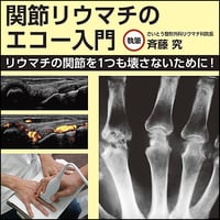 関節リウマチのエコー入門～リウマチの関節を1つも壊さないために！