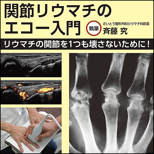 関節リウマチのエコー入門~リウマチの関節を1つも壊さないため 関節リウマチのエコー入門~リウマチの関節を1つも壊さないため