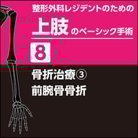 整形外科レジデントのための上肢のベーシック手術9 骨折治療4 整形外科レジデントのための上肢のベーシック手術9 骨折治療4