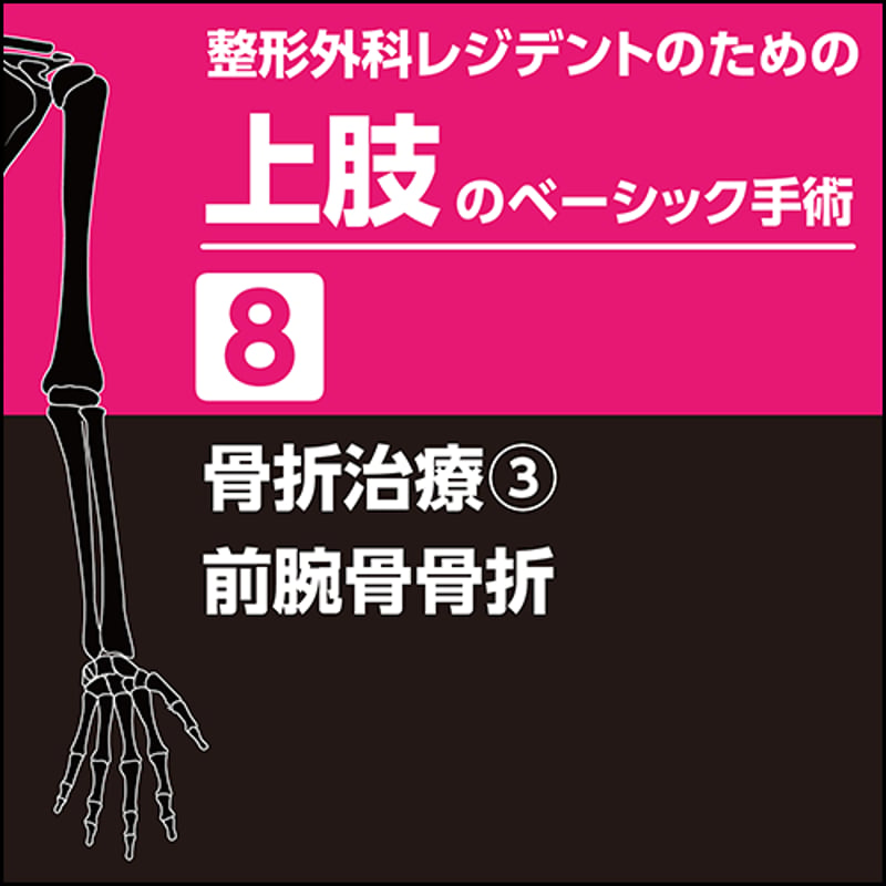 整形外科レジデントのための上肢のベーシック手術8 骨折治療3 前腕骨