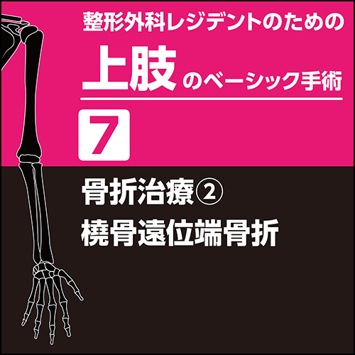 整形外科レジデントのための上肢のベーシック手術7 骨折治療2 橈骨遠位