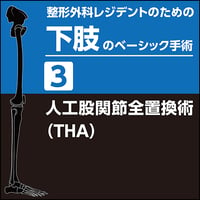 整形外科レジデントのための脊椎のベーシック手術8 頚椎症性脊髄症