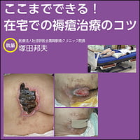 ここまでできる！ 在宅での褥瘡治療のコツ