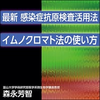 〈最新〉感染症抗原検査活用法〜イムノクロマト法の使い方