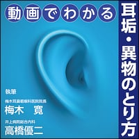 動画でわかる 耳垢・異物のとり方