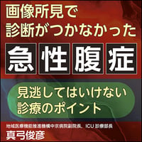 画像所見で診断がつかなかった急性腹症〈見逃してはいけない診療のポイント〉