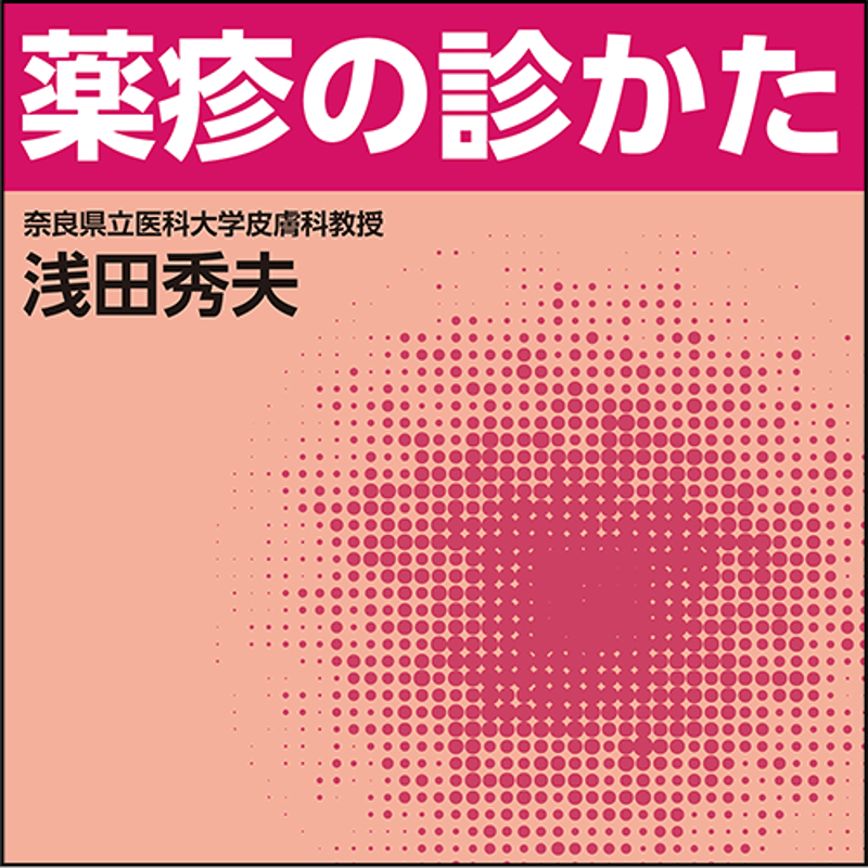 薬疹の診かた | 日本医事新報社 Webコンテンツ販売サイト