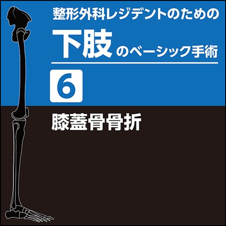 整形外科レジデントのための下肢のベーシック手術6　膝蓋骨骨折（PDF版）