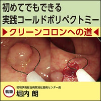 初めてでもできる実践コールドポリペクトミー〜クリーンコロンへの道