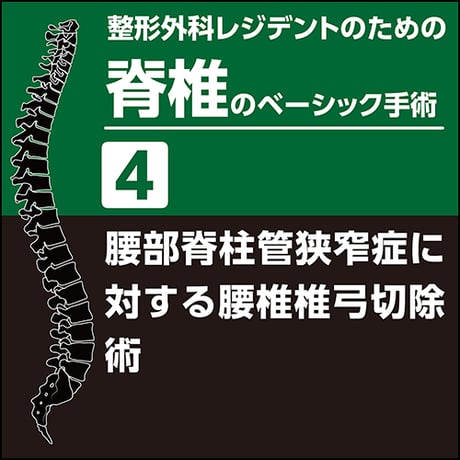 整形外科レジデントのための脊椎のベーシック手術4　腰部脊柱管狭窄症に対する腰椎椎弓切除術（PDF版）