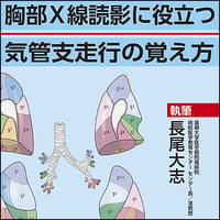 胸部X線読影に役立つ 気管支走行の覚え方