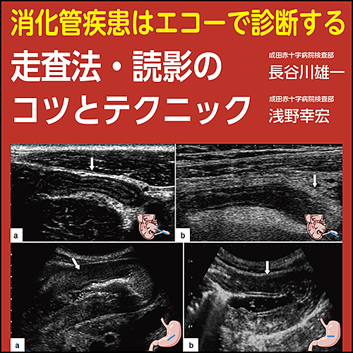 消化管疾患はエコーで診断する〜走査法・読影のコツとテクニック