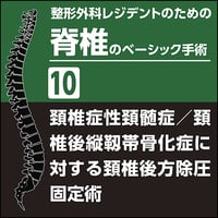 整形外科レジデントのための上肢のベーシック手術7 骨折治療2