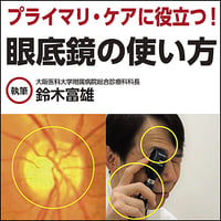 プライマリ・ケアに役立つ！眼底鏡の使い方
