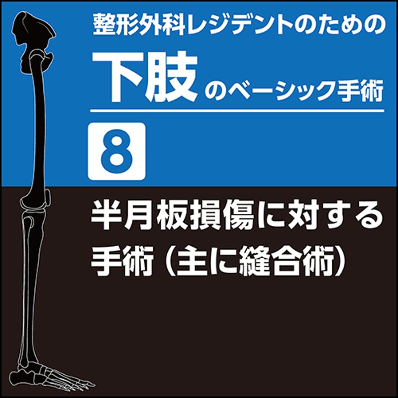 整形外科レジデントのための下肢のベーシック手術8 半月板損傷 整形外科レジデントのための下肢のベーシック手術8 半月板損傷