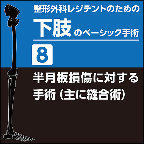 整形外科レジデントのための下肢のベーシック手術8 半月板損傷に対する