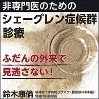 非専門医のためのシェーグレン症候群診療〈ふだんの外来で見逃さない！〉