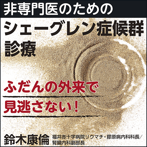 シェーグレン症候群の基礎と臨床 [単行本] 一朗，片山 楽天市場】【 書 籍 】目が乾く、口も乾く、関節が痛む、疲れも
