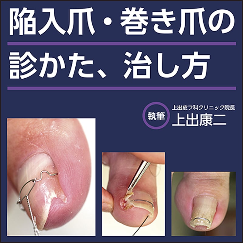 爪　基礎から臨床まで 爪 基礎から臨床まで 改訂第2版 | 東 禹彦 |本 | 通販 | Amazon