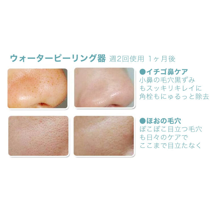 新品未使用 オーシャンブルー 毛穴ケアウォーターピーリング 美顔器 fit=scale-down,w=1200