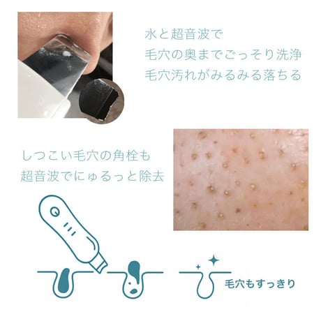 毛穴ケア美顔器 ウォーターピーリング器