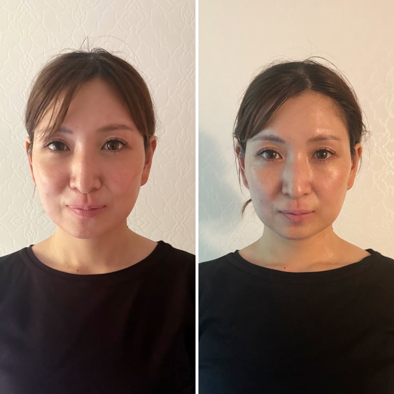 流して引き上げ】テラヘルツカッサ | elicagioia