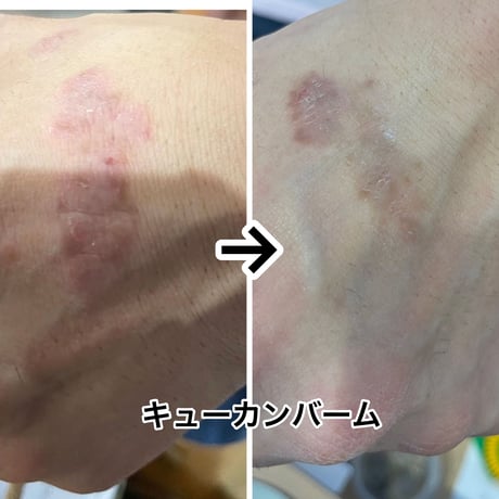 老若男女リピートNo1！保湿 大バーム　　40g 送料無料