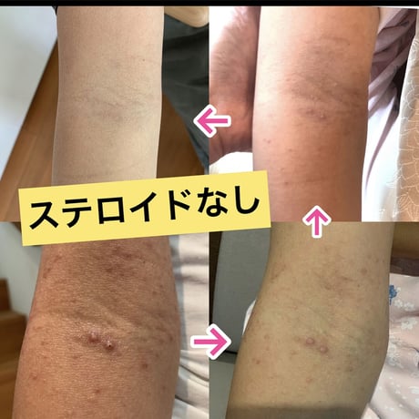 老若男女リピートNo1！保湿 大バーム　　40g 送料無料