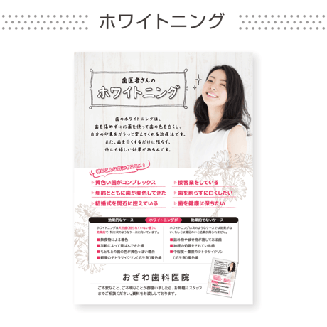 啓発ポスター【ホワイトニング】（データ制作+印刷費用込）