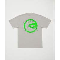 BAL eye