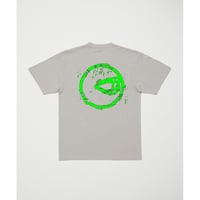 BAL eye