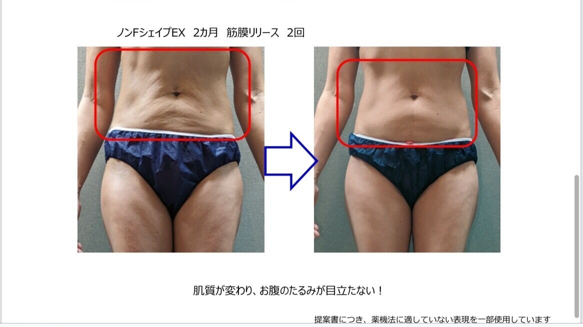 マッコイ ノンFシェイプEX 2本セット 新発売】7月7日、待望の