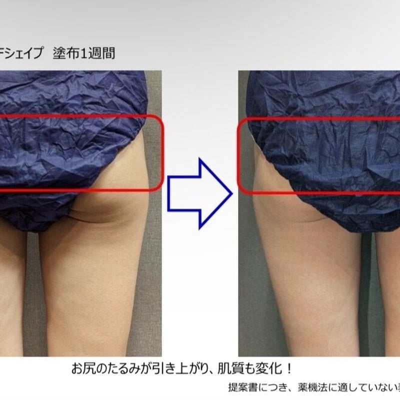 再入荷🌸たるみに‼️【ノンFシェイプ】二の腕・お腹・ヒップ