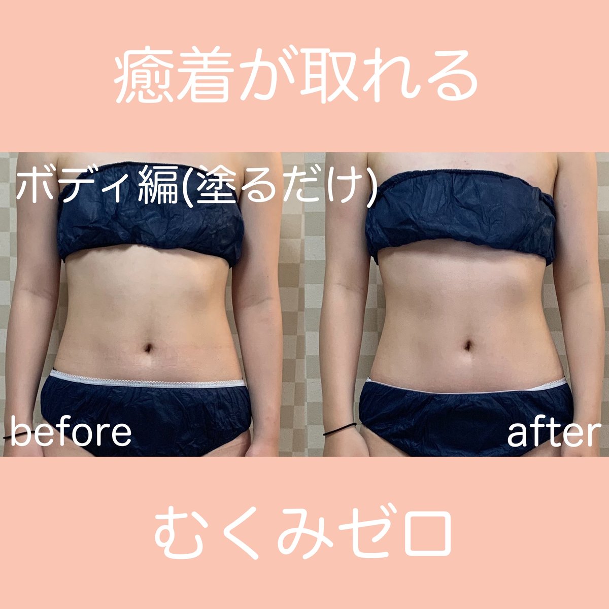 ゼロジーフリー 1000ml 徳用