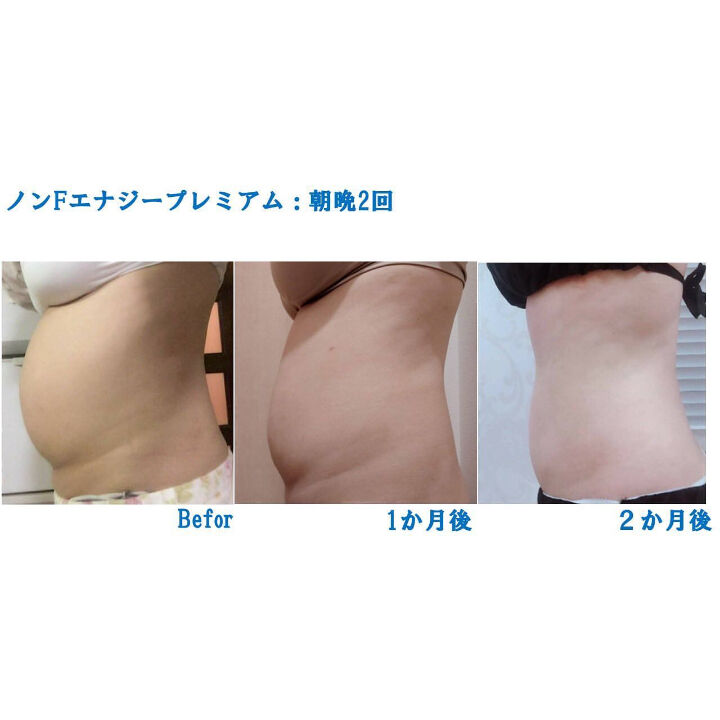 ノンFエナジープレミアム(背中・太ももガチガチ) | Esthesalon