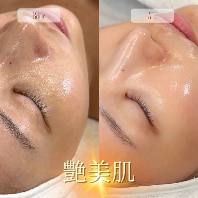 SkinGlowMask スキングロウマスク 100ml | Rare skin.