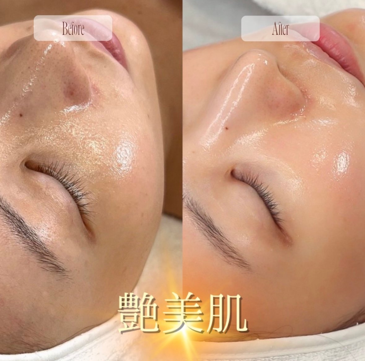 SkinGlowMask スキングロウマスク 100ml | Rare skin.