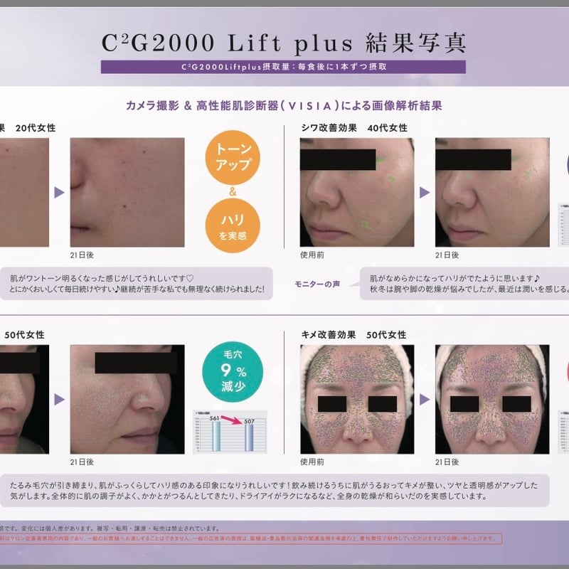 2/24新発売！！】メソシューティカルインサイド C2G2000Lift plus | Ra