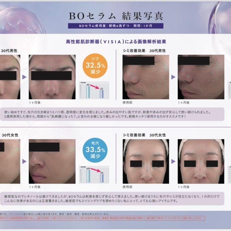 メソシューティカル新製品】BOセラム 10ml | Rare skin.