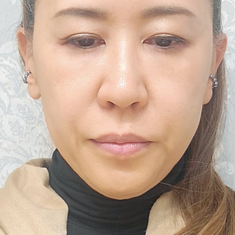 人気過ぎる♡テラヘルツ鉱石 テラケア®️イヤカフ♡《ALLテラヘルツ