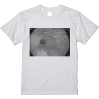 胃カメラ Tシャツ