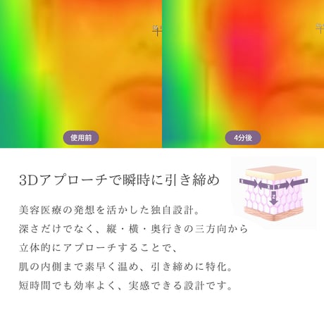 キャトルリフト