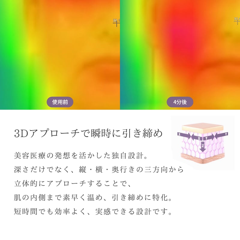 キャトルリフト！　新品未使用 キャトルリフト | yukino kikaku