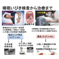 睡眠検査と結果の解釈