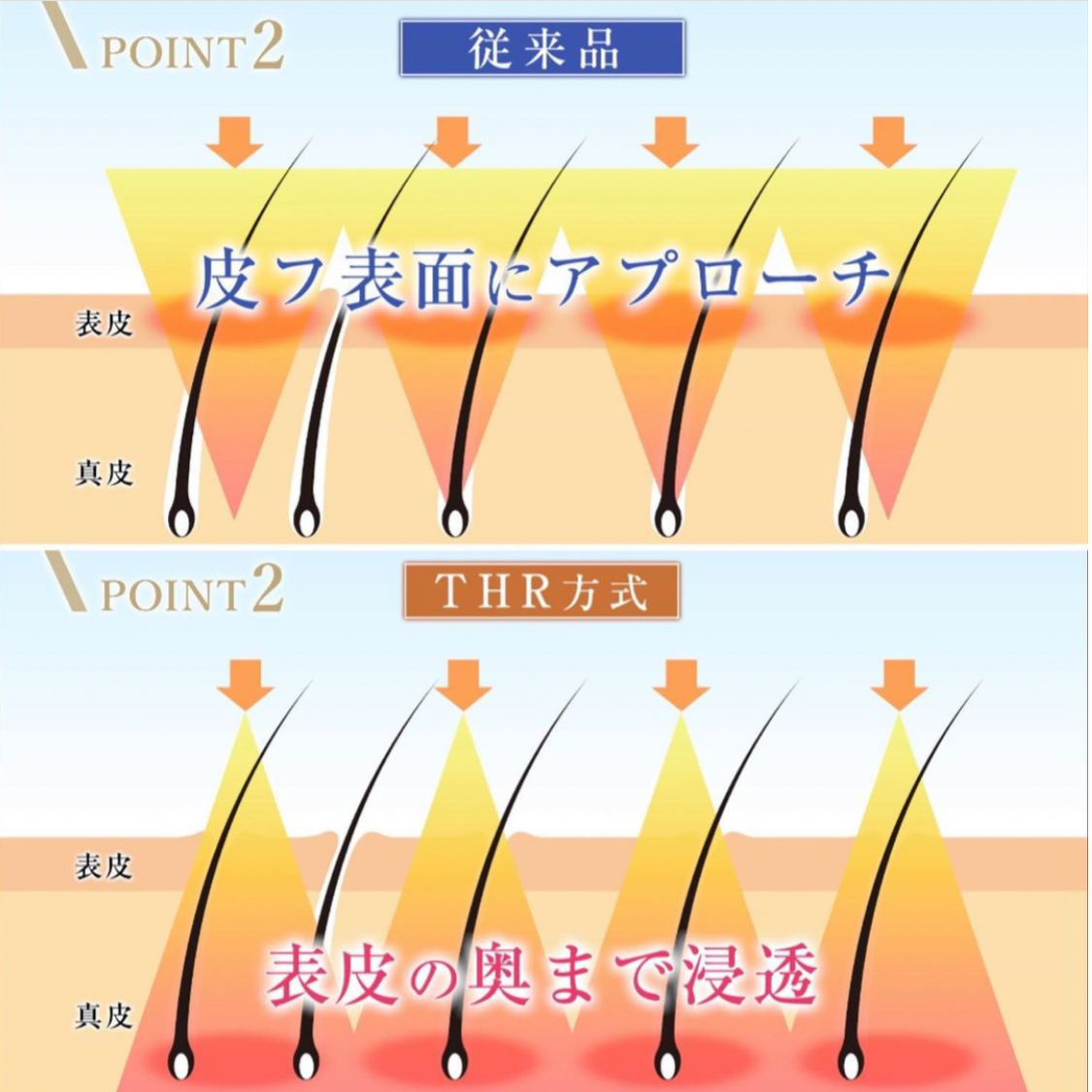 効果抜群の家庭用脱毛器 クリアエスピー ビート2 CLEAR/SP biiTo II スタンダ...