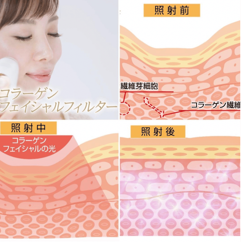 白かピンクです！家庭用脱毛器 KIREIMO EPI PHOTO CRYSTAL