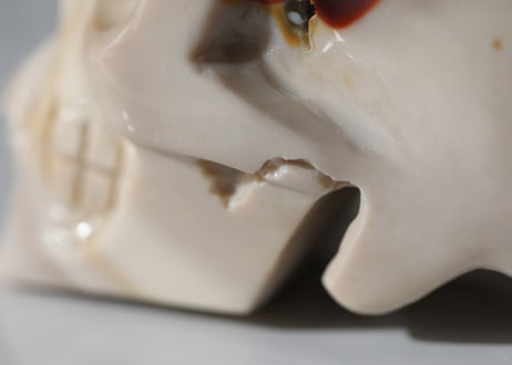 【賢者の眼差し】ムーカイトジャスパー スカル
