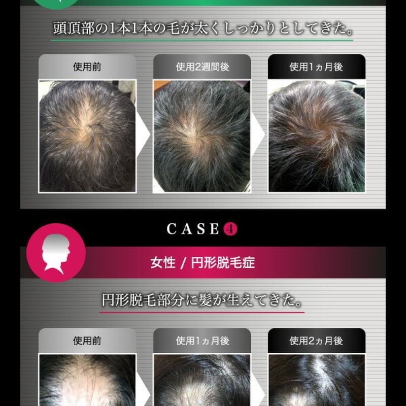 MOST HAIR モストヘアー 頭皮用美容液 150ml | GSストアー