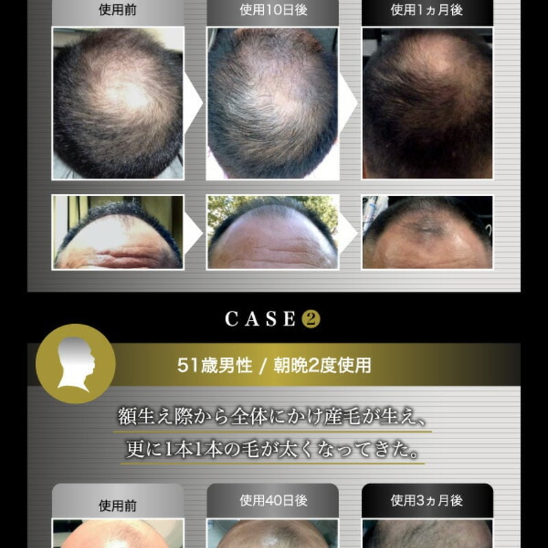 MOST HAIR モストヘアー 頭皮用美容液 150ml | GSストアー